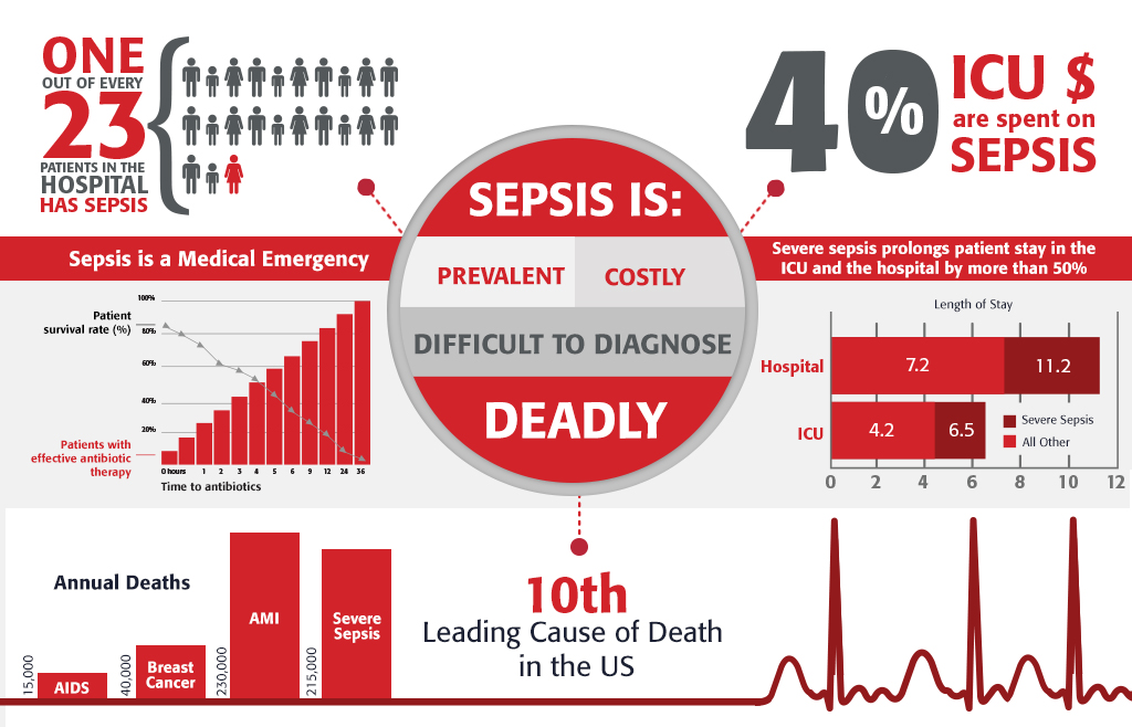 Sepsis: Every Second Counts